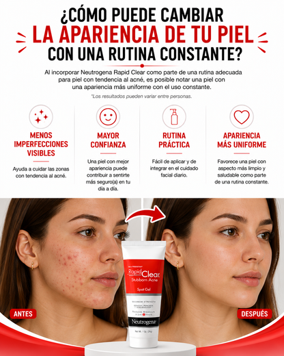 Rapid Clear-Gel de tratamiento de mancha y Acné