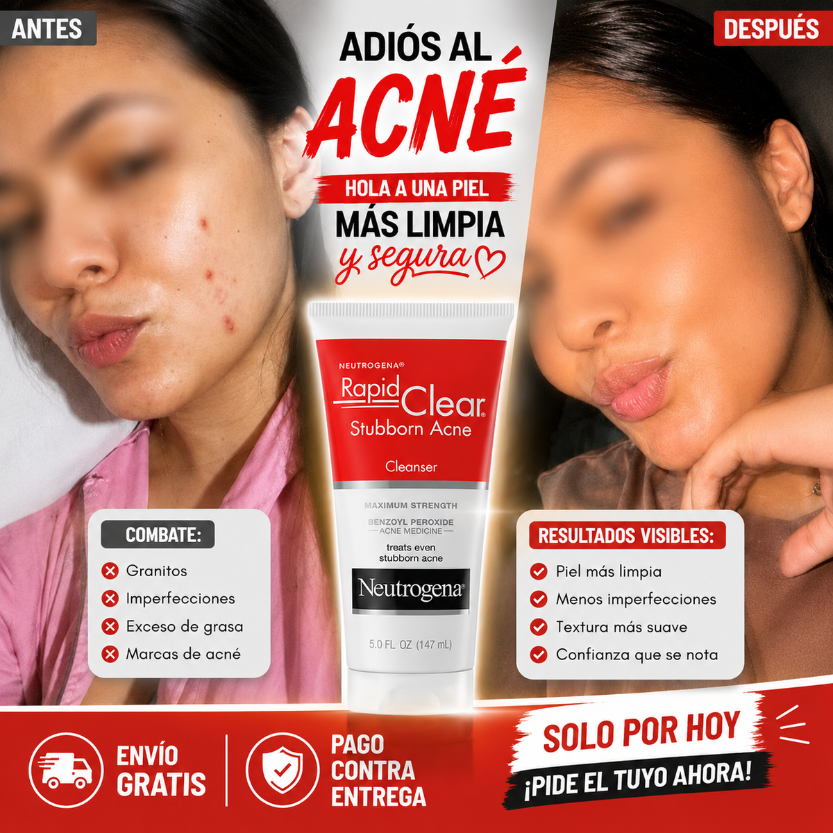 Rapid Clear-Gel de tratamiento de mancha y Acné